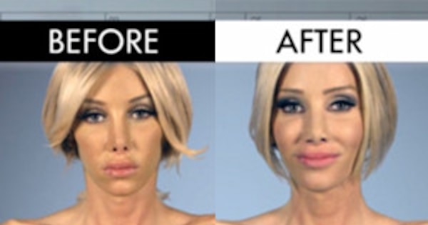 See the Mind-Blowing Before and After Pics of Botched Patients! | E! News Australia